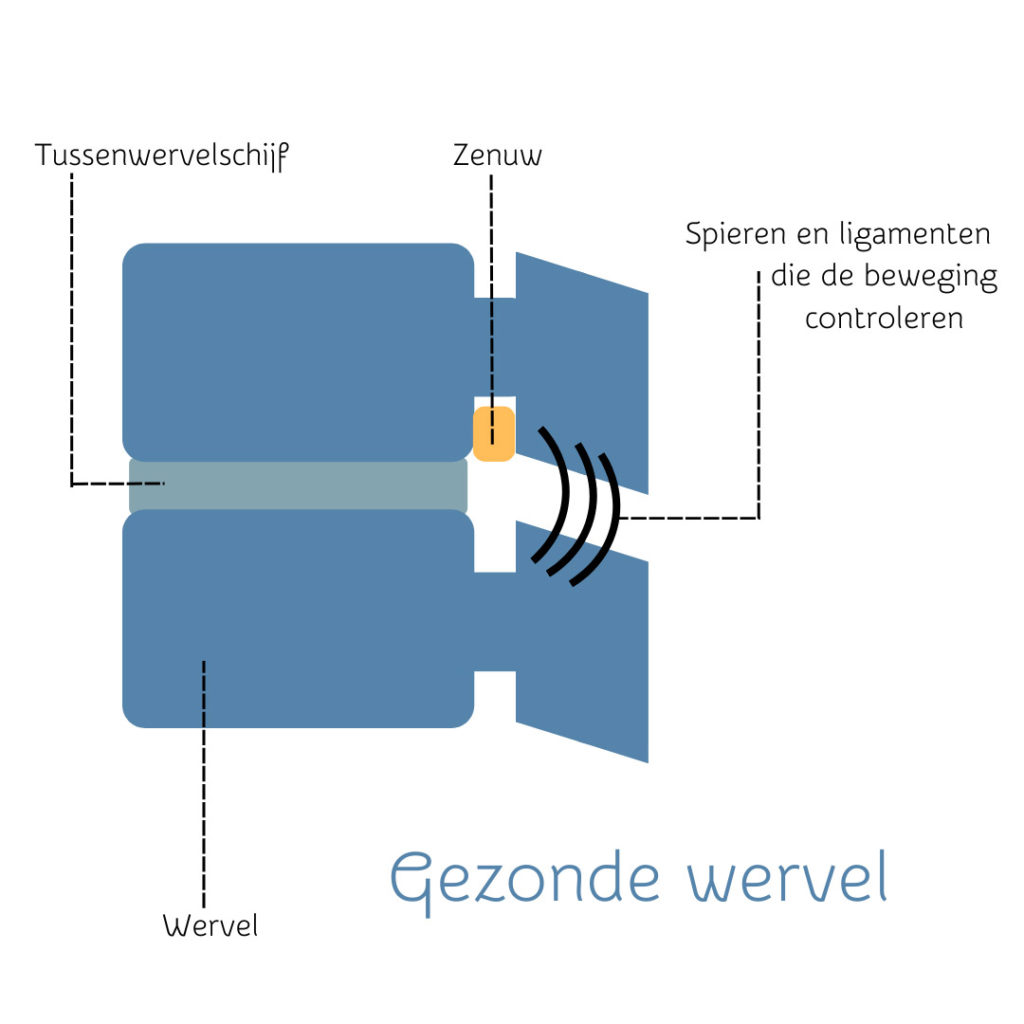 trc afbeelding blog gezonde wervel